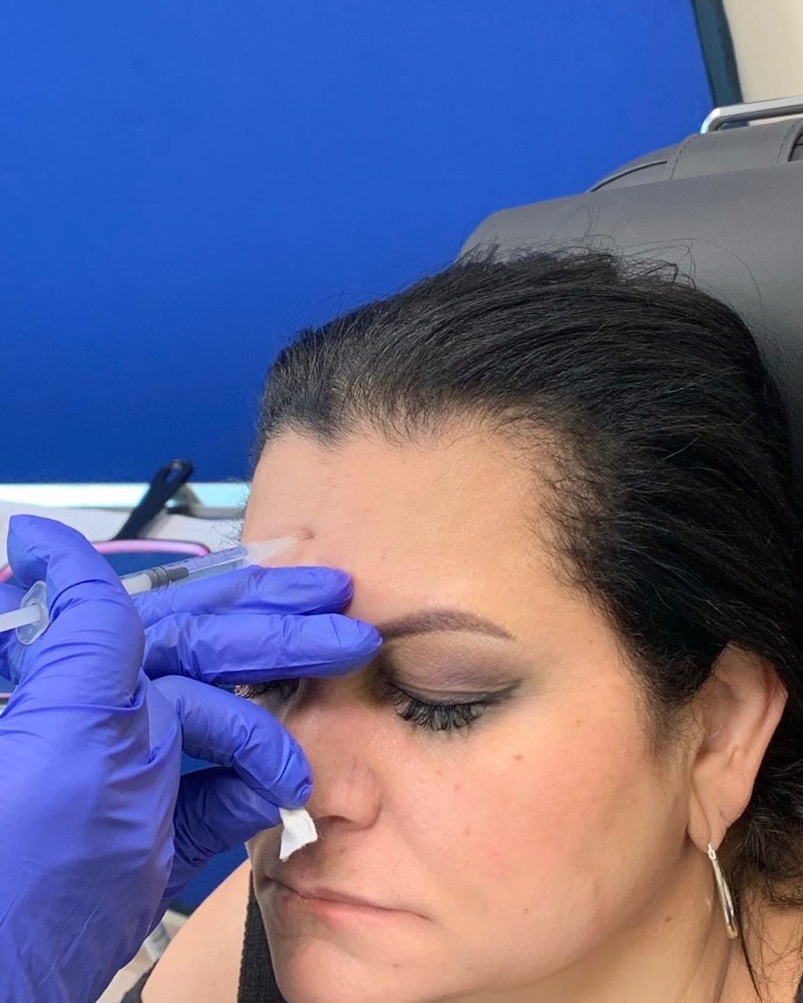 Clinician in blue gloves administering Botox injection to patient's forehead